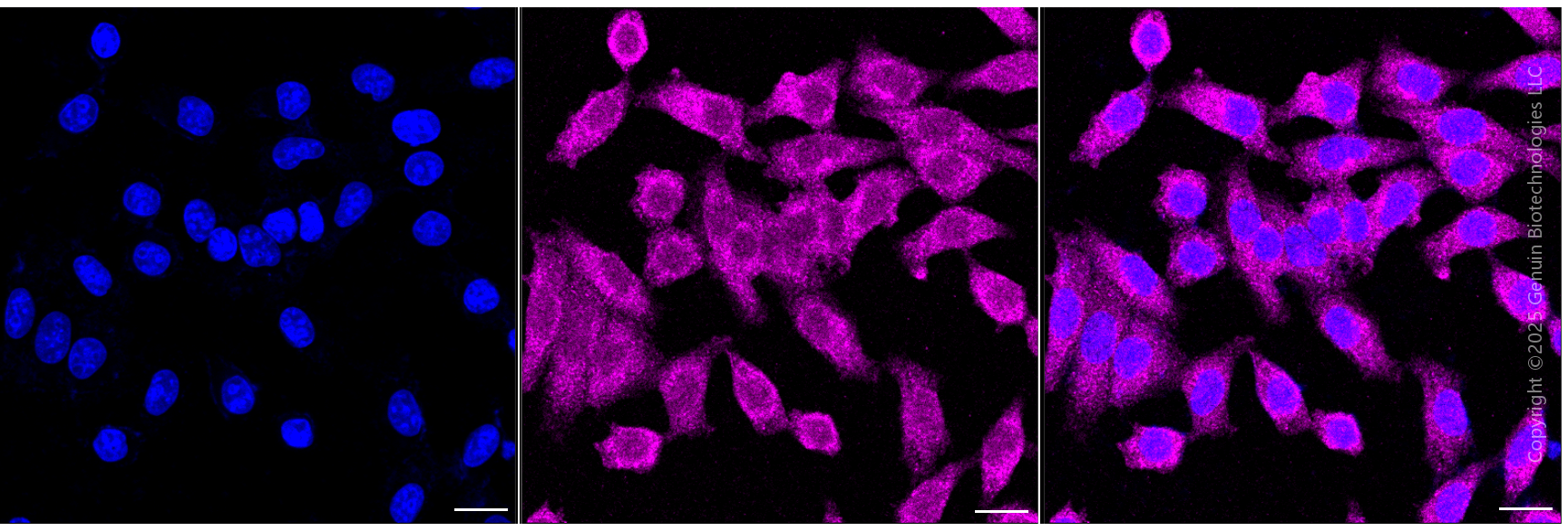 KD-Validated Anti-Clathrin Heavy Chain Rabbit Monoclonal Antibody ABG1984