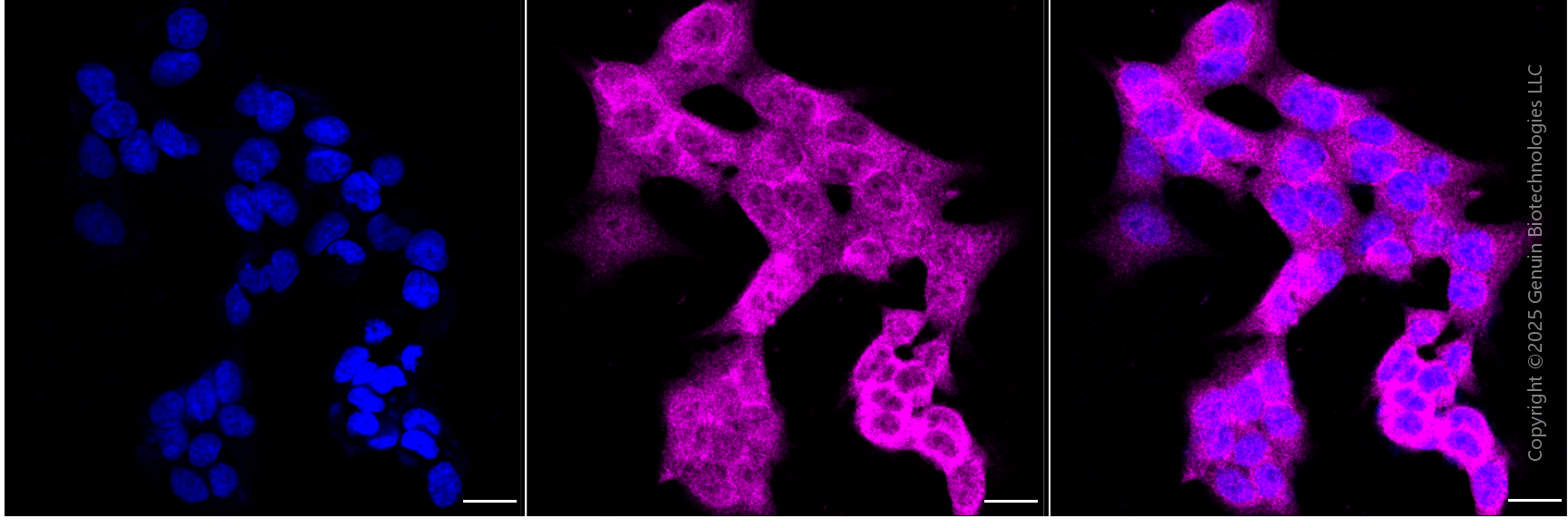 KD-Validated Anti-Creatine Kinase B Mouse Monoclonal Antibody ABG1987