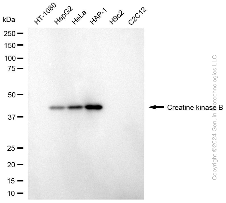 KD-Validated Anti-Creatine Kinase B Mouse Monoclonal Antibody ABG1987