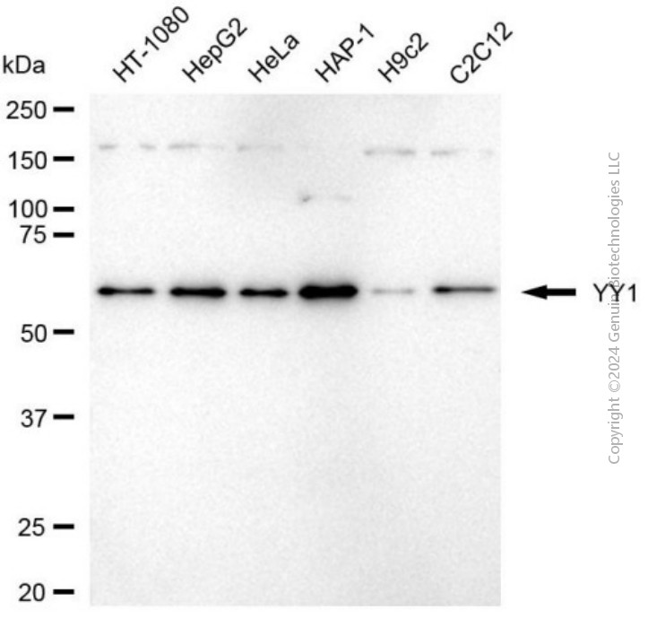 KD-Validated Anti-YY1 Mouse Monoclonal Antibody ABG1988