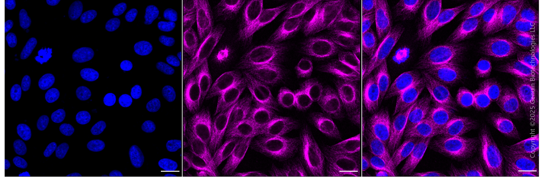 KD-Validated Anti-FLT1 Mouse Monoclonal Antibody ABG1992