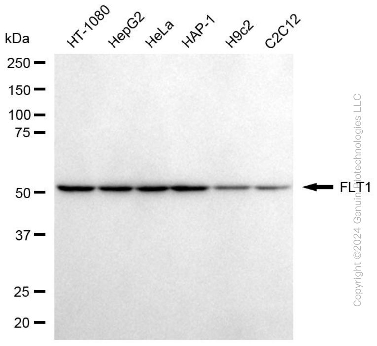 KD-Validated Anti-FLT1 Mouse Monoclonal Antibody ABG1992