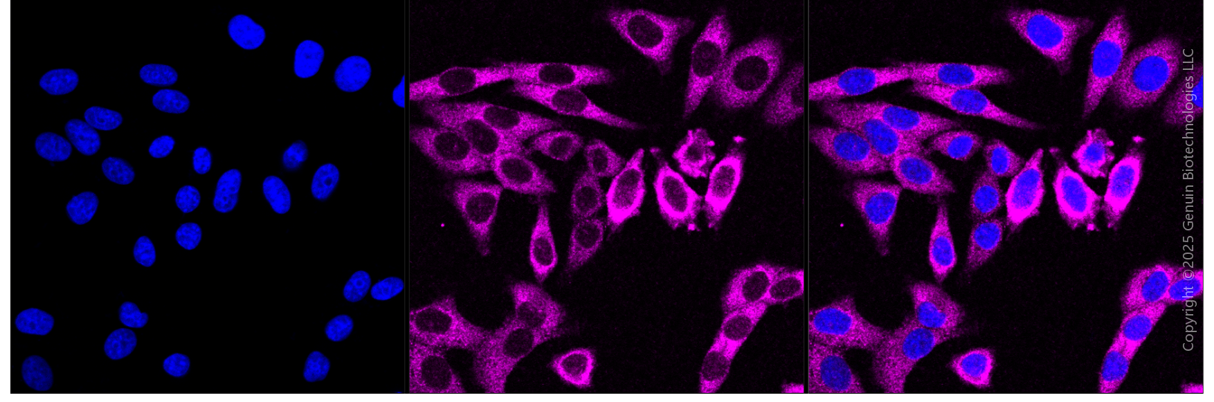 KD-Validated Anti-EIF2AK2 Mouse Monoclonal Antibody ABG1993