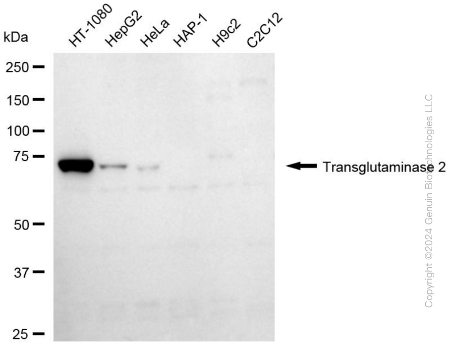 KD-Validated Anti-Transglutaminase 2 Mouse Monoclonal Antibody ABG1994