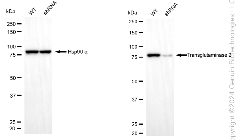 KD-Validated Anti-Transglutaminase 2 Mouse Monoclonal Antibody ABG1994