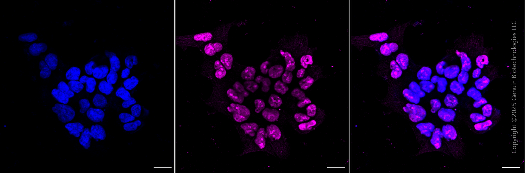 KD-Validated Anti-EZH2 Mouse Monoclonal Antibody ABG1998