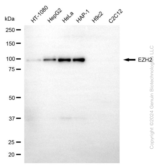 KD-Validated Anti-EZH2 Mouse Monoclonal Antibody ABG1998