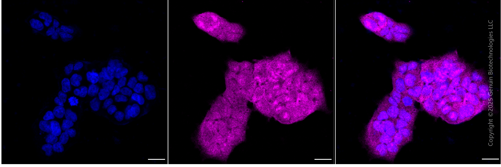 KD-Validated Anti-Lin-28 Homolog B Mouse Monoclonal Antibody ABG1999