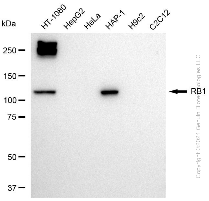 KD-Validated Anti-RB1 Rabbit Polyclonal Antibody ABG2003