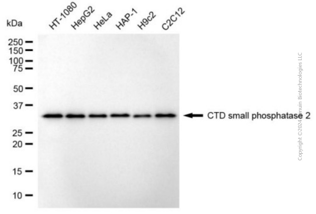 KD-Validated Anti-CTDSP2 Mouse Monoclonal Antibody ABG2020
