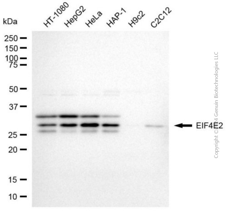 KD-Validated Anti-EIF4E2 Mouse Monoclonal Antibody ABG2027