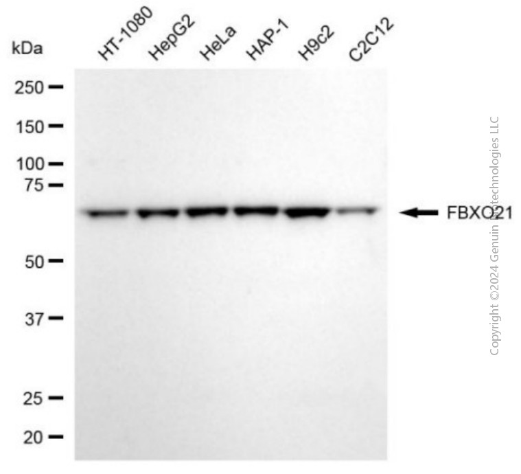 KD-Validated Anti-FBXO21 Mouse Monoclonal Antibody ABG2029