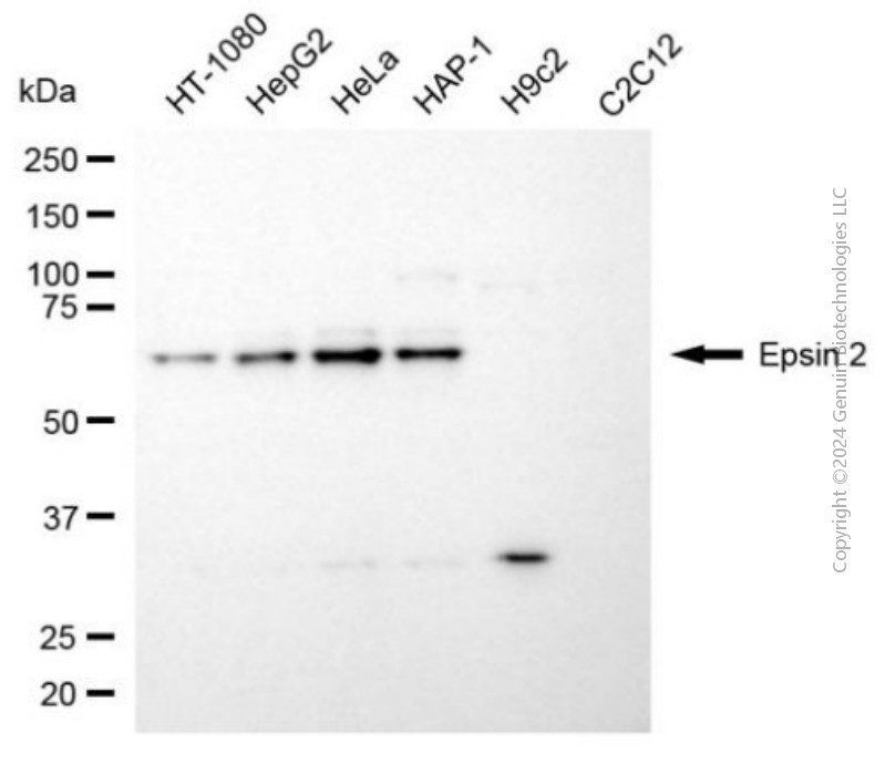 KD-Validated Anti-Epsin 2 Mouse Monoclonal Antibody ABG2032