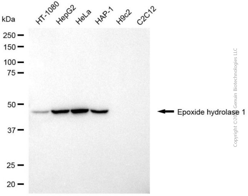 KD-Validated Anti-EPHX1 Mouse Monoclonal Antibody ABG2035
