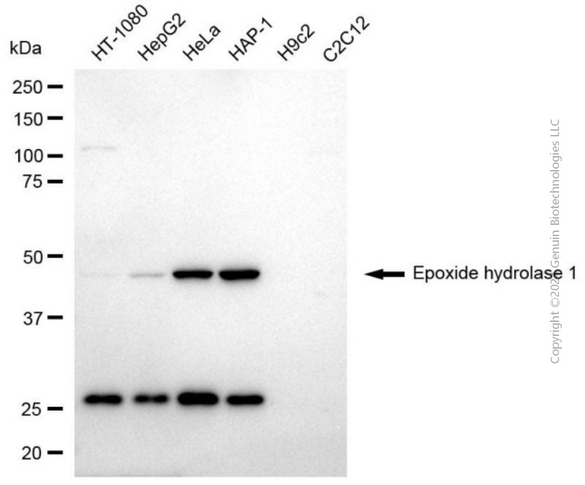KD-Validated Anti-Epoxide Hydrolase 1 Mouse Monoclonal Antibody ABG2036