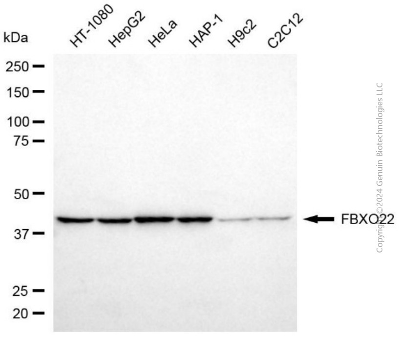 KD-Validated Anti-FBXO22 Mouse Monoclonal Antibody ABG2045