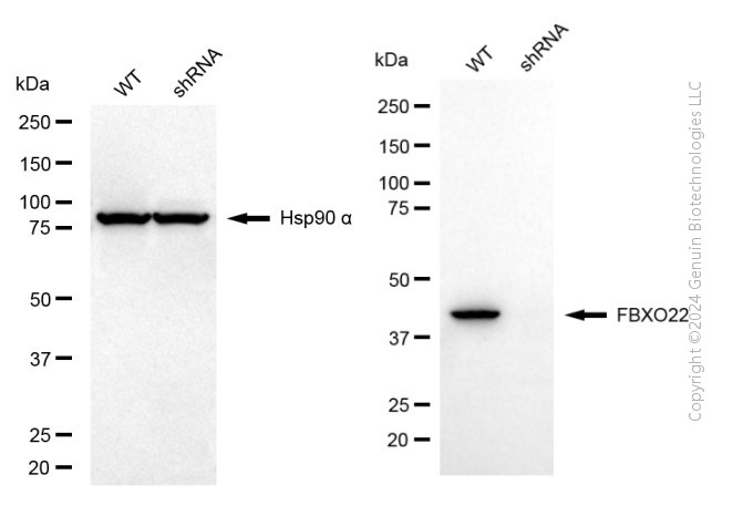 KD-Validated Anti-FBXO22 Mouse Monoclonal Antibody ABG2045