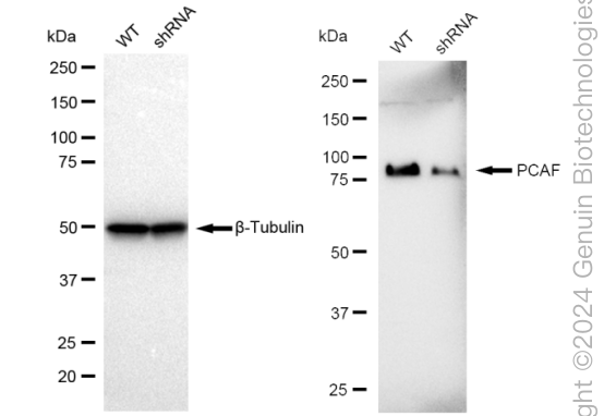 KD-Validated Anti-PCAF Rabbit Monoclonal Antibody ABG2049