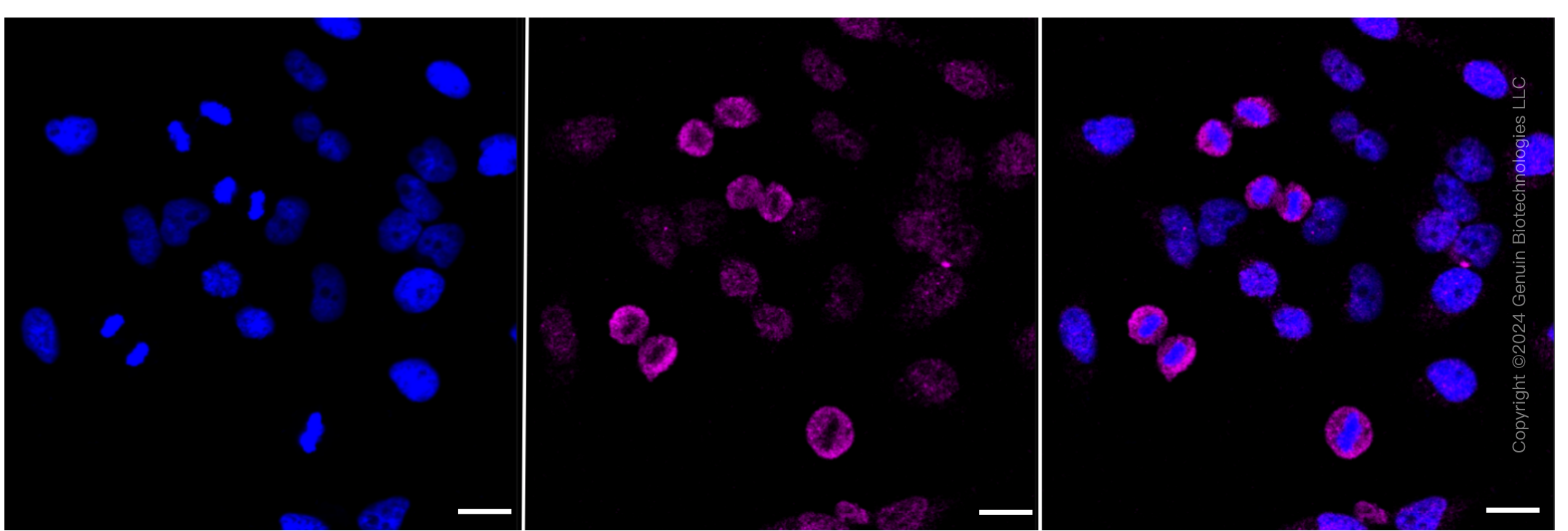KD-Validated Anti-LAMP1 /CD107a Rabbit Monoclonal Antibody ABG2050