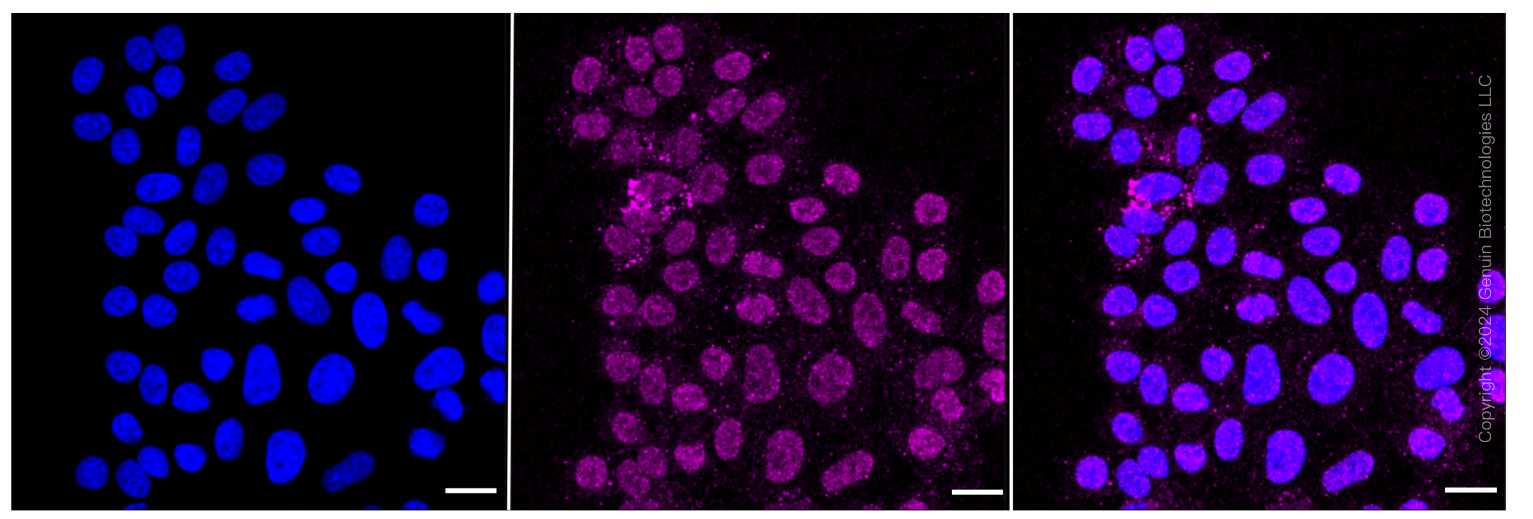 KD-Validated Anti-Erb-b2 receptor tyrosine kinase 2 Rabbit Monoclonal Antibody ABG2053