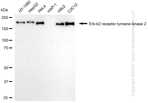 KD-Validated Anti-Erb-b2 receptor tyrosine kinase 2 Rabbit Monoclonal Antibody ABG2053