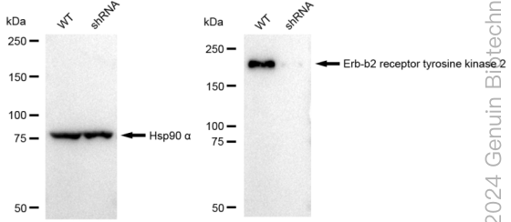 KD-Validated Anti-Erb-b2 receptor tyrosine kinase 2 Rabbit Monoclonal Antibody ABG2053