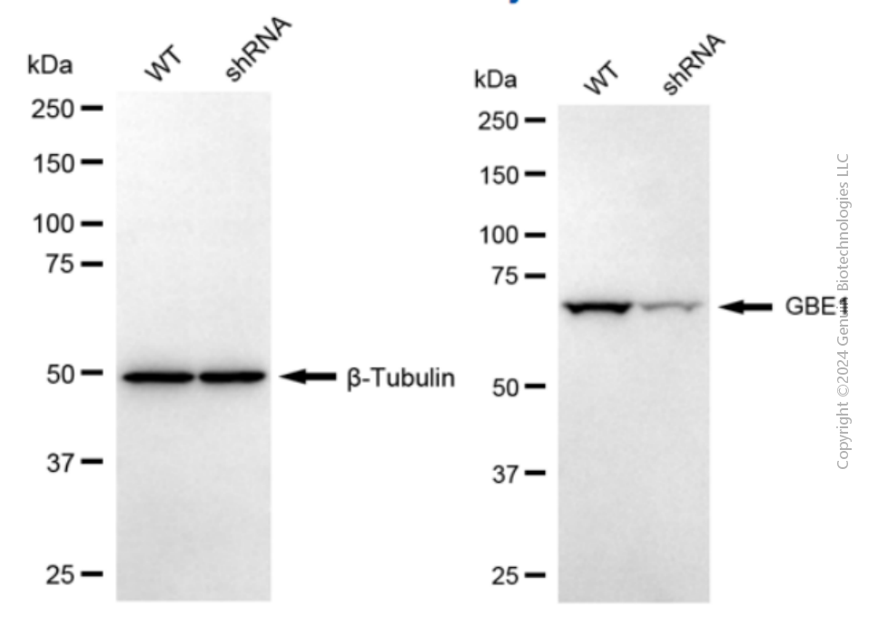 KD-Validated Anti-GBE1 Mouse Monoclonal Antibody ABG2056