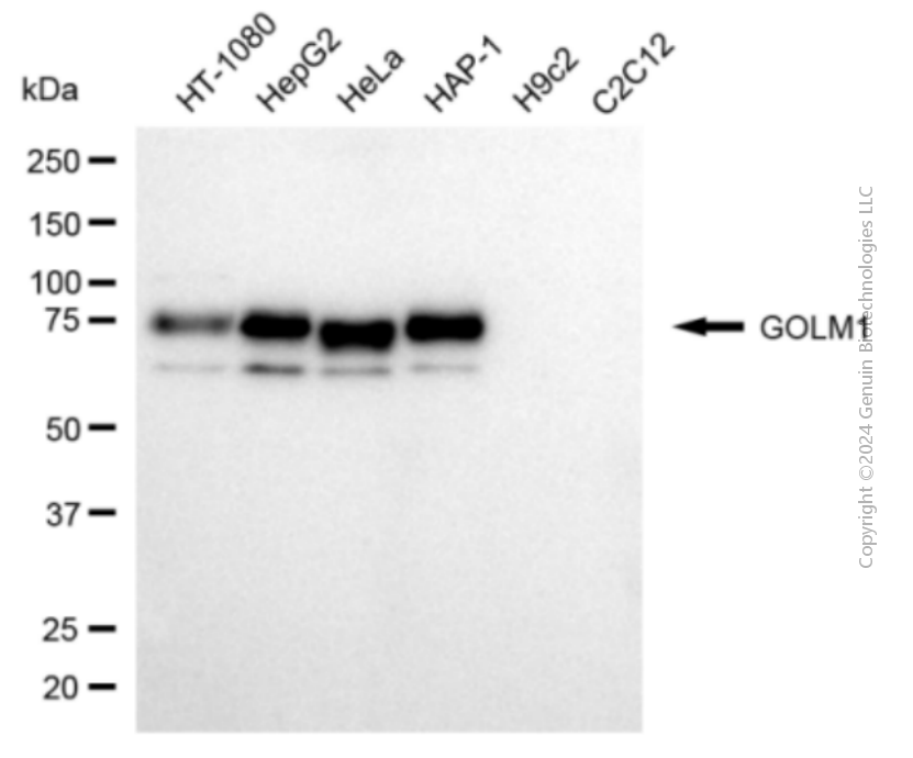 KD-Validated Anti-GOLM1 Mouse Monoclonal Antibody ABG2061