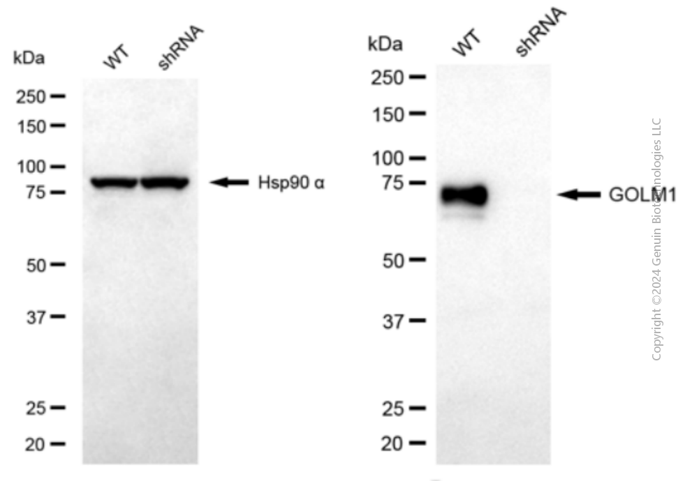 KD-Validated Anti-GOLM1 Mouse Monoclonal Antibody ABG2061