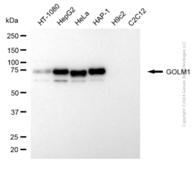 KD-Validated Anti-GOLM1 Mouse Monoclonal Antibody ABG2062