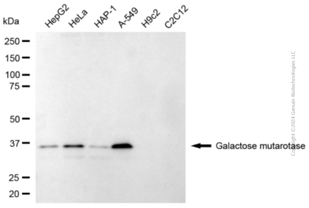KD-Validated Anti-Galactose Mutarotase Mouse Monoclonal Antibody ABG2072