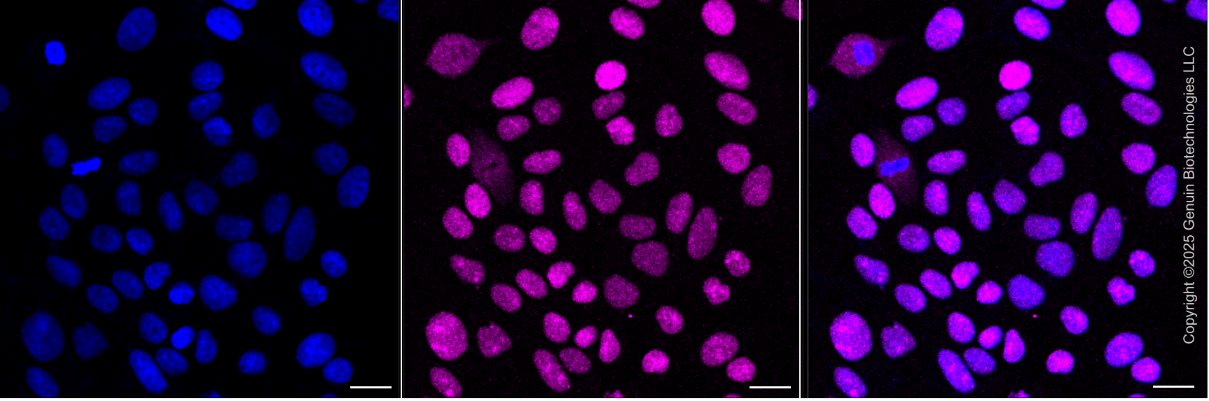 KD-Validated Anti-SSB Mouse Monoclonal Antibody ABG2073