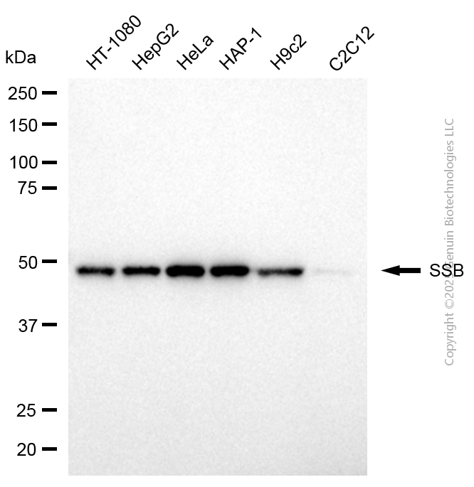 KD-Validated Anti-SSB Mouse Monoclonal Antibody ABG2073