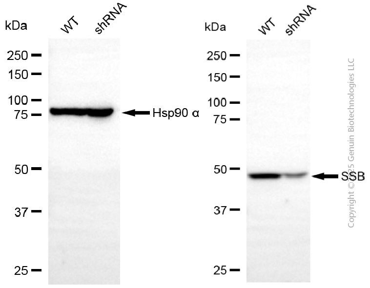 KD-Validated Anti-SSB Mouse Monoclonal Antibody ABG2073