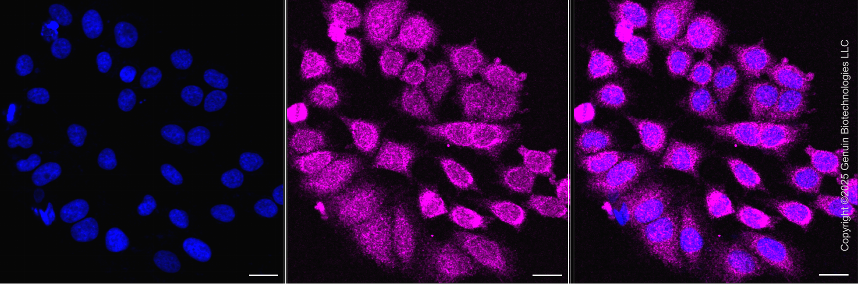 KD-Validated Anti-Sirtuin 5 Mouse Monoclonal Antibody ABG2080
