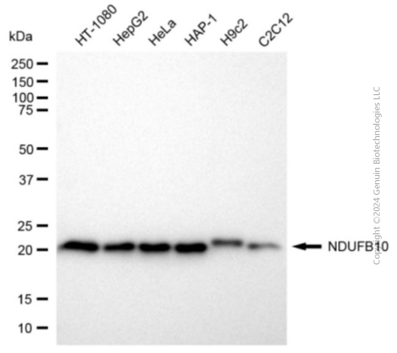 KD-Validated Anti-NDUFB10 Mouse Monoclonal Antibody ABG2082