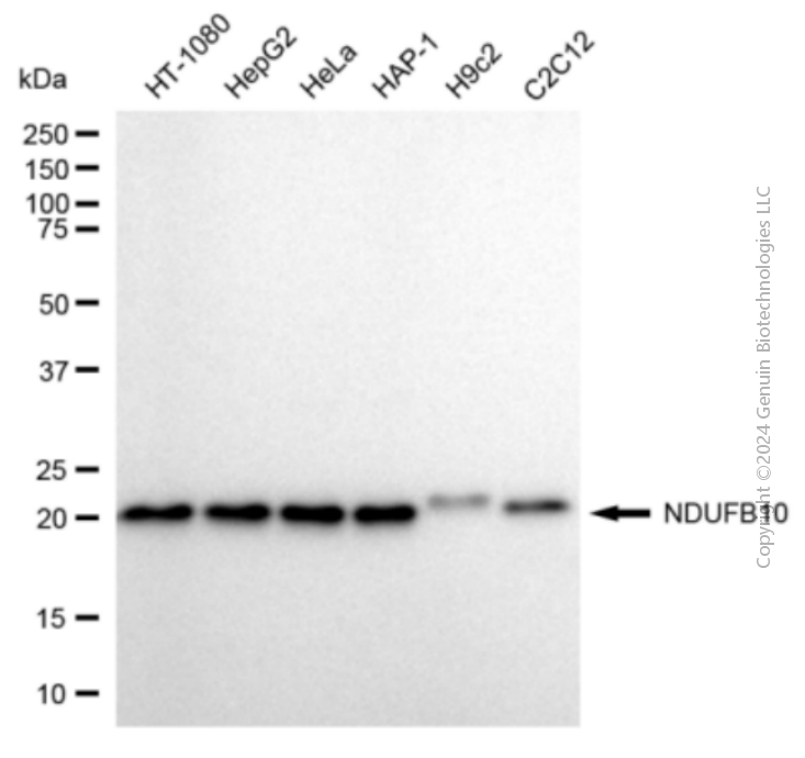 KD-Validated Anti-NDUFB10 Mouse Monoclonal Antibody ABG2083