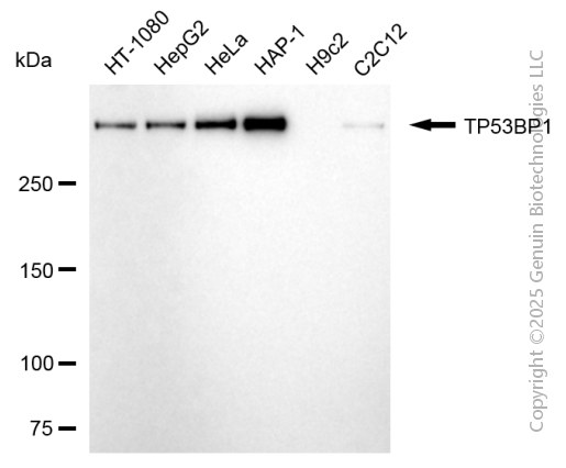 KD-Validated Anti-TP53BP1 Mouse Monoclonal Antibody ABG2089