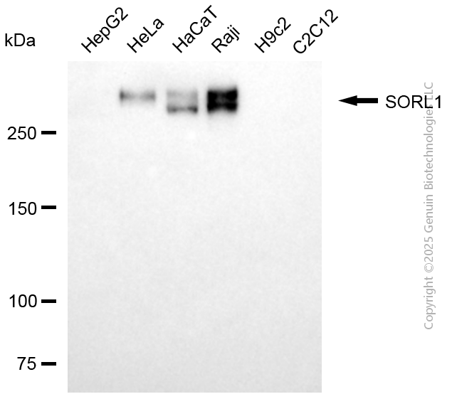KD-Validated Anti-SORL1 Mouse Monoclonal Antibody ABG2096