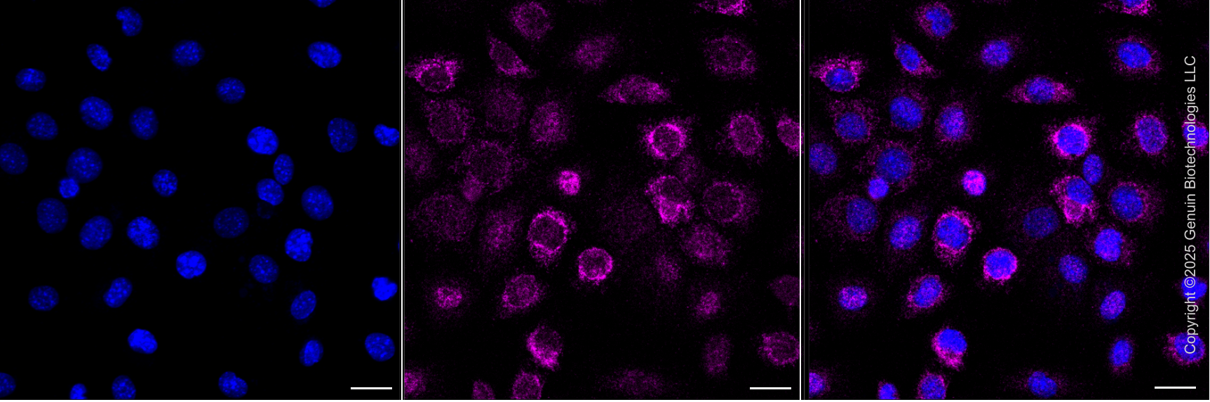 KD-Validated Anti-IFNGR1 Rabbit Monoclonal Antibody ABG2104