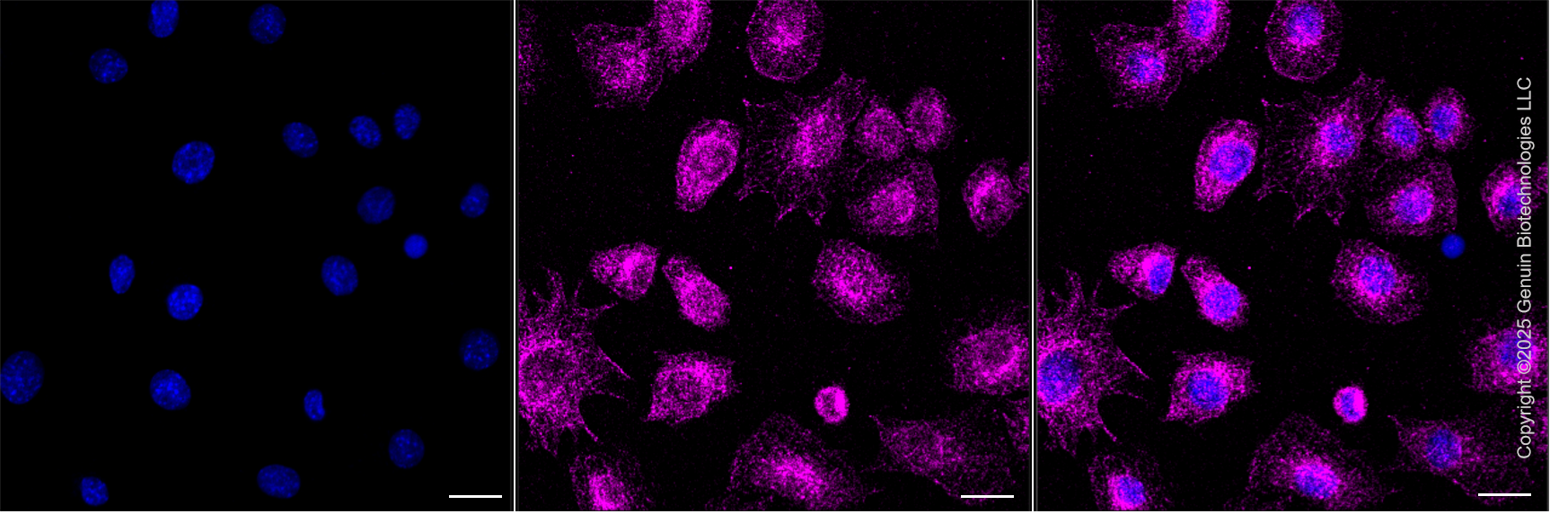 KD-Validated Anti-NPC2 Rabbit Monoclonal Antibody ABG2106