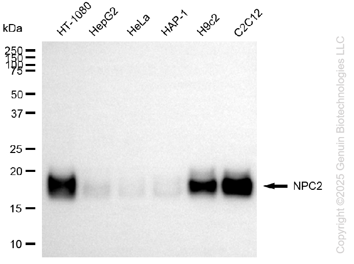 KD-Validated Anti-NPC2 Rabbit Monoclonal Antibody ABG2106