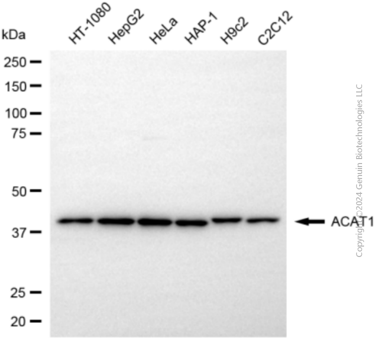 KD-Validated Anti-ACAT1 Rabbit Polyclonal Antibody ABG2113