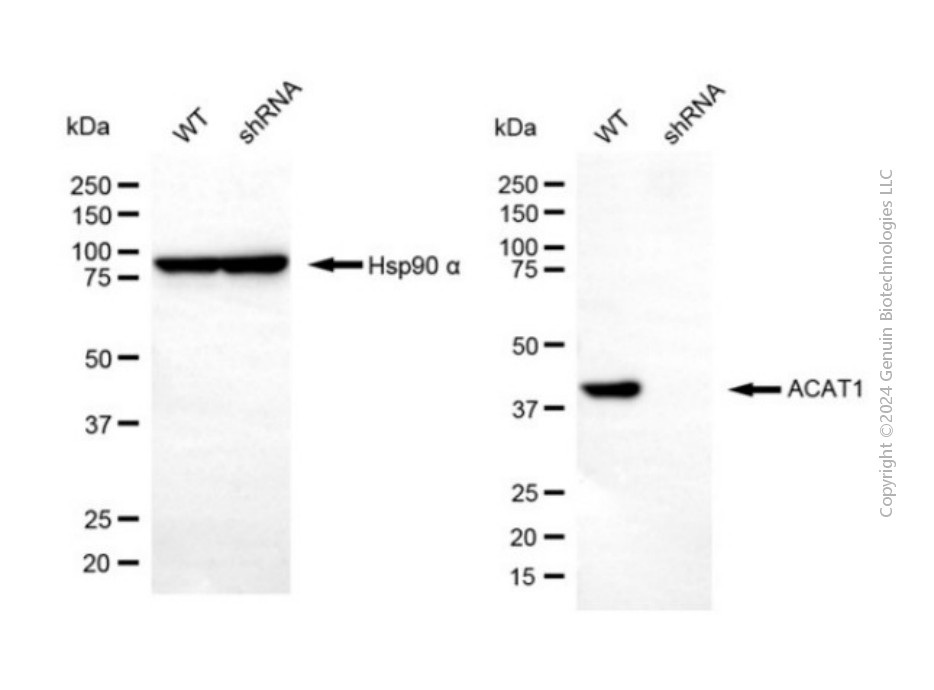 KD-Validated Anti-ACAT1 Rabbit Polyclonal Antibody ABG2113