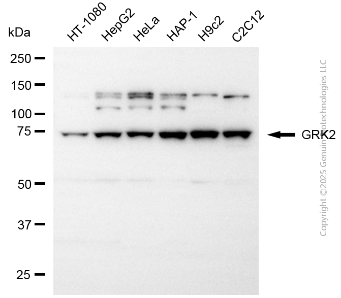 KD-Validated Anti-GRK2 Rabbit Polyclonal Antibody ABG2114
