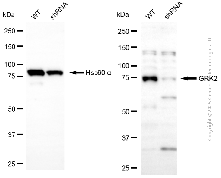 KD-Validated Anti-GRK2 Rabbit Polyclonal Antibody ABG2114