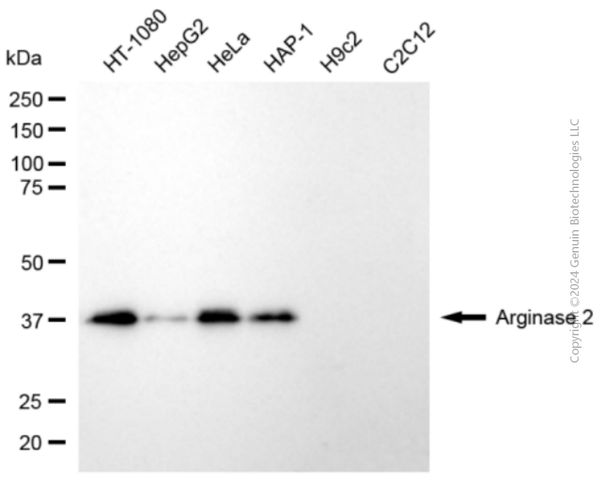 KD-Validated Anti-Arginase 2 Rabbit Polyclonal Antibody ABG2115