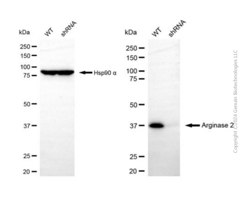 KD-Validated Anti-Arginase 2 Rabbit Polyclonal Antibody ABG2115