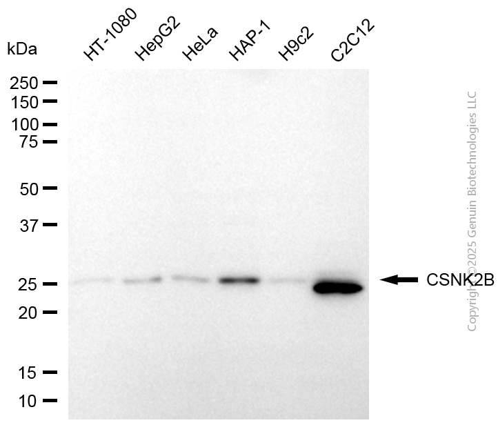 KD-Validated Anti-CSNK2B Rabbit Polyclonal Antibody ABG2119