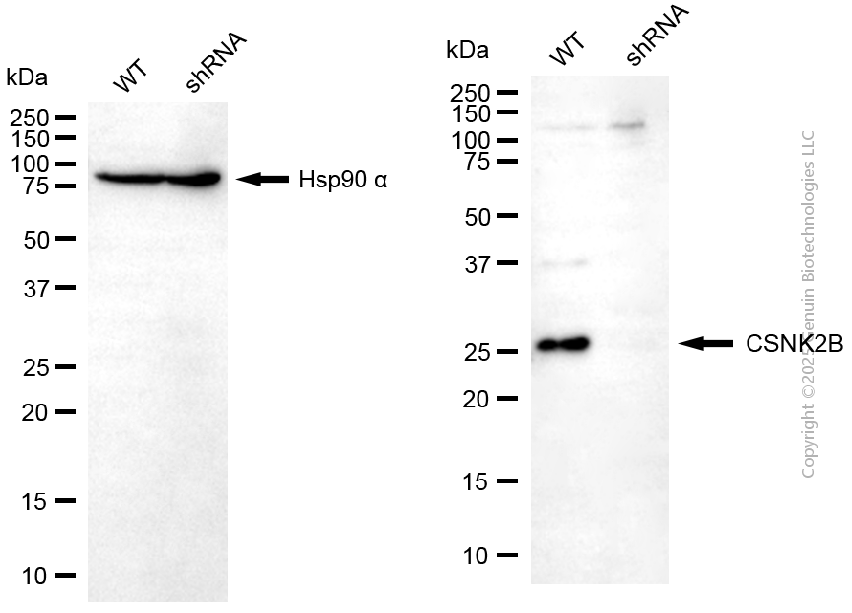 KD-Validated Anti-CSNK2B Rabbit Polyclonal Antibody ABG2119